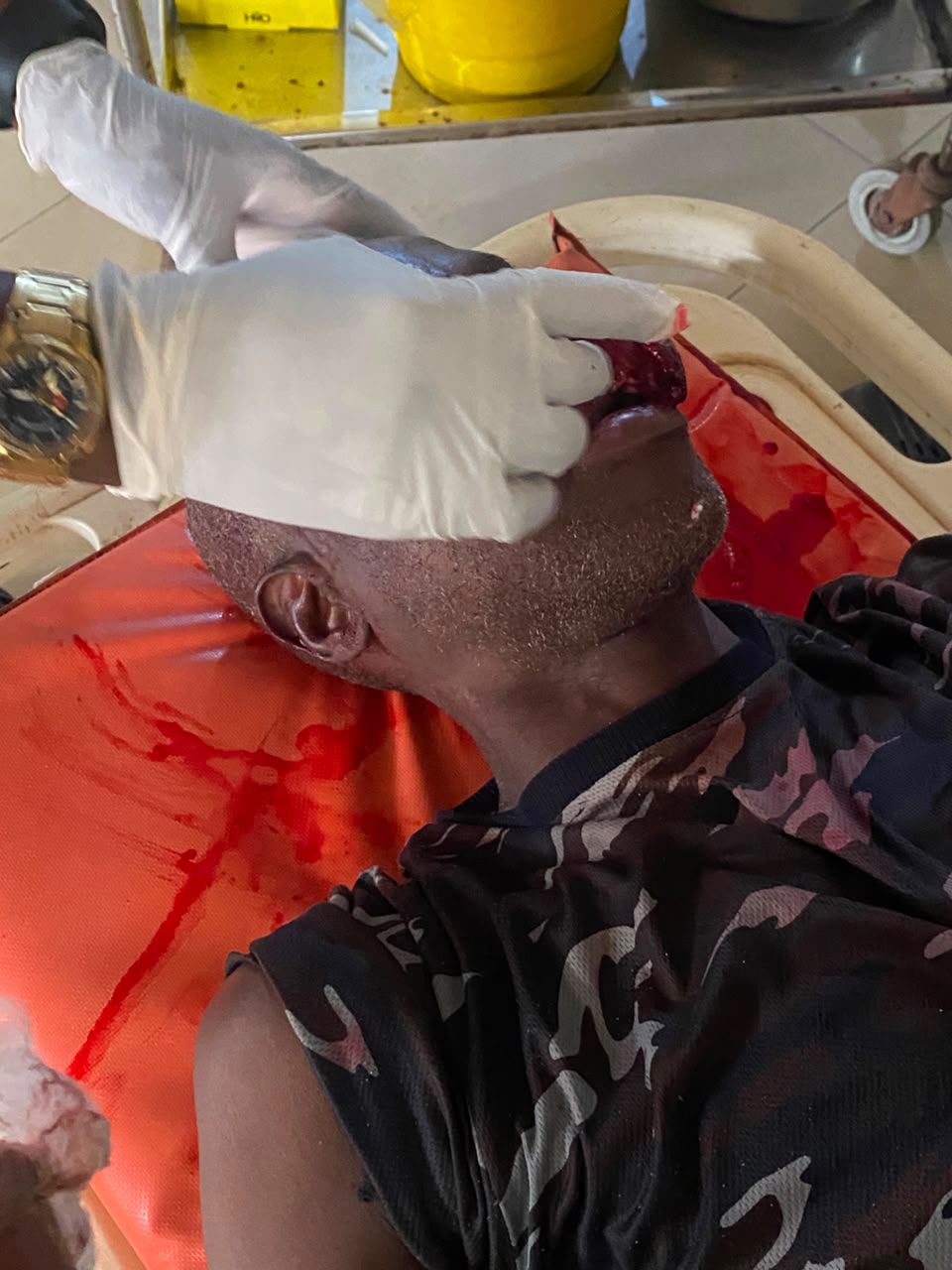 POLICE INSPECTOR SHOT IN FACE AFTER ALTERCATION WITH CONSTABLE IN LAGOS POLICE INSPECTOR SHOT IN FACE AFTER ALTERCATION WITH CONSTABLE IN LAGOS