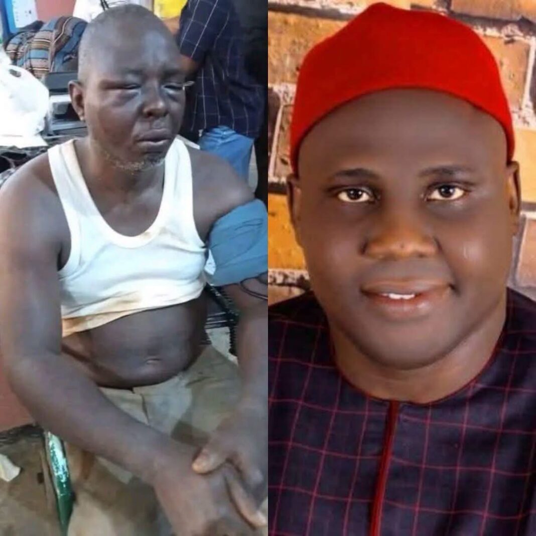 Two Weeks After Arrest of Delta Commissioner Kingsley Ashibogwu, Questions Remain Over Unity Adeda Death Case Two Weeks After Arrest of Delta Commissioner Kingsley Ashibogwu, Questions Remain Over Unity Adeda Death Case